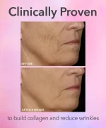 DRx SpectraLite FaceWare Pro 3-Minute LED Device - Image 5