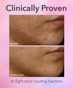 DRx SpectraLite FaceWare Pro 3-Minute LED Device - Image 6