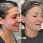 Megelin LED Red Light Therapy Face Mask - White - Image 10