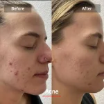 Megelin LED Red Light Therapy Face Mask - Black - Image 5