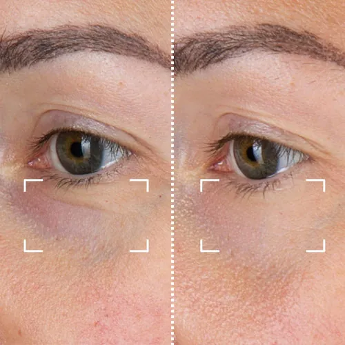 Before and after result