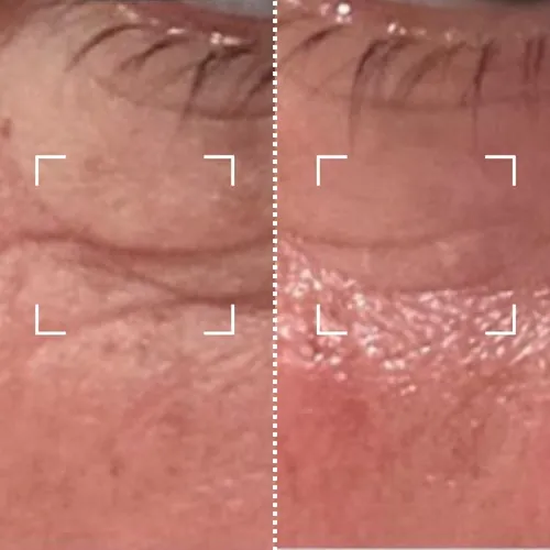 Before and after result