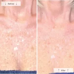 Omnilux Contour Neck & Décolleté - Image 9