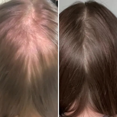 Before and after result