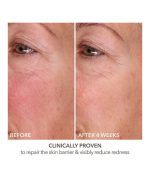 DermInfusions Fill + Sérum Réparateur à l'Acide Hyaluronique – Image 6