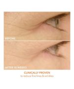 Appareil LED DRx SpectraLite EyeCare Max Pro – Image 5